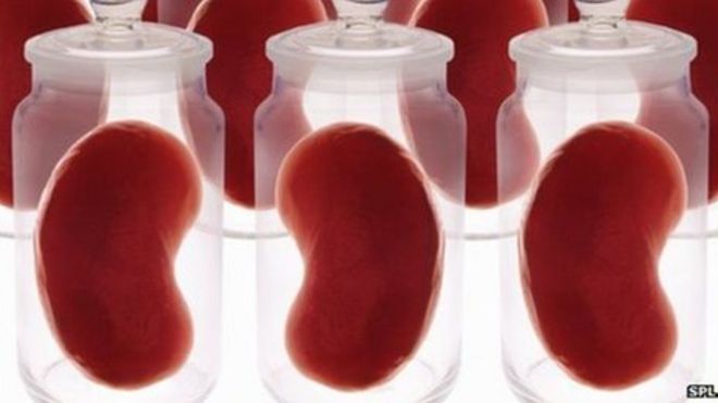 hospitals-urge-muslims-to-donate-organs