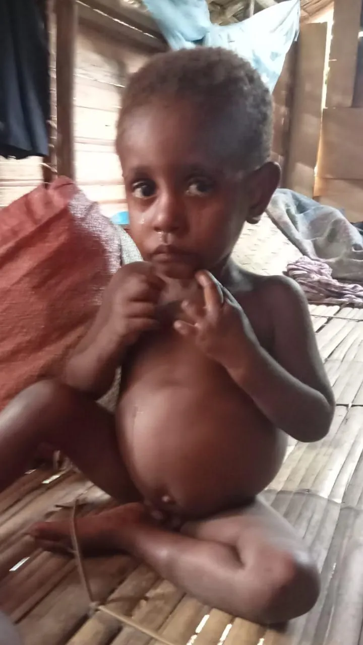 Perayaan HUT RI ke-77 di tengah jerit pengungsi Papua