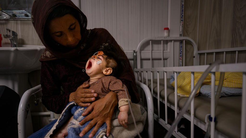 Bencana Kelaparan Landa Afghanistan, 3,2 Juta Bayi Alami Malnutrisi Akut