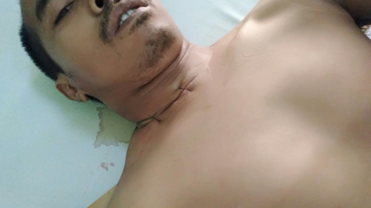 PENGGALANGAN DANA BUAT ID ZEWENY4 (KANG SIS)