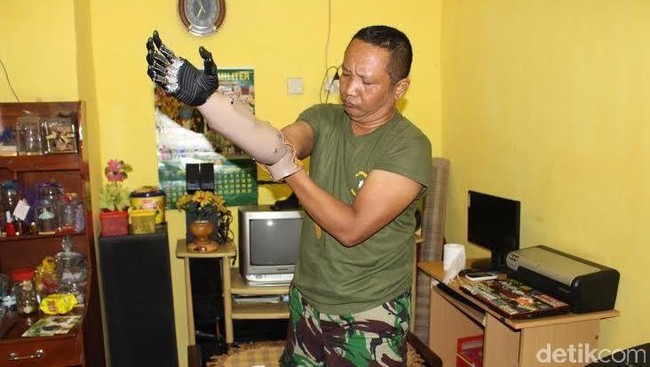 Next Ironman - Kisah Serka Siswandi dan Tangan Bionik