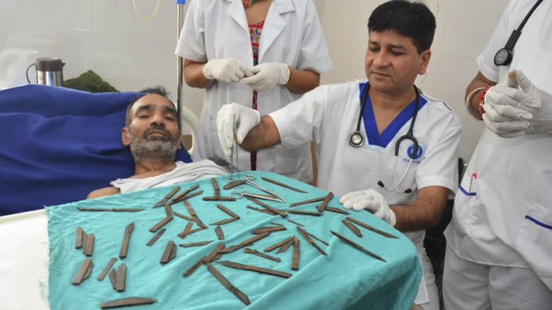 Pria India ini Telan 40 Pisau Selama 3 Bulan, Dokter Berhasil Mengambilnya