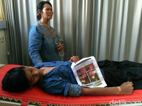 Susah BAB, Zainurrifin Coba Masukkan Pulpen Lewat Anus