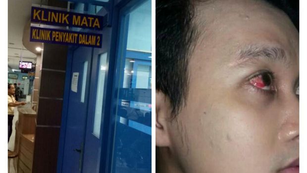 Dipukuli Driver Grab, Korban Akhirnya Angkat Bicara