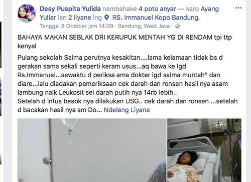 kerupuk-seblak-picu-radang-usus-buntu-ini-kata-dokter-pencernaan