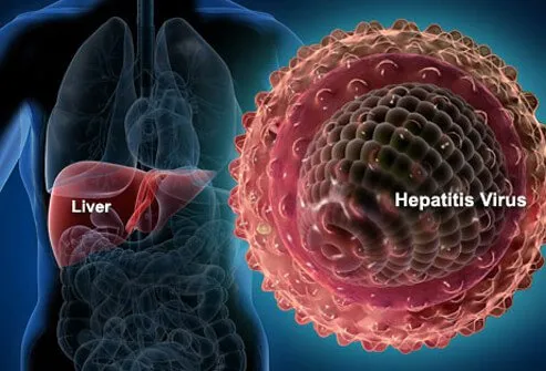 &#91;All About&#93; Hepatitis B