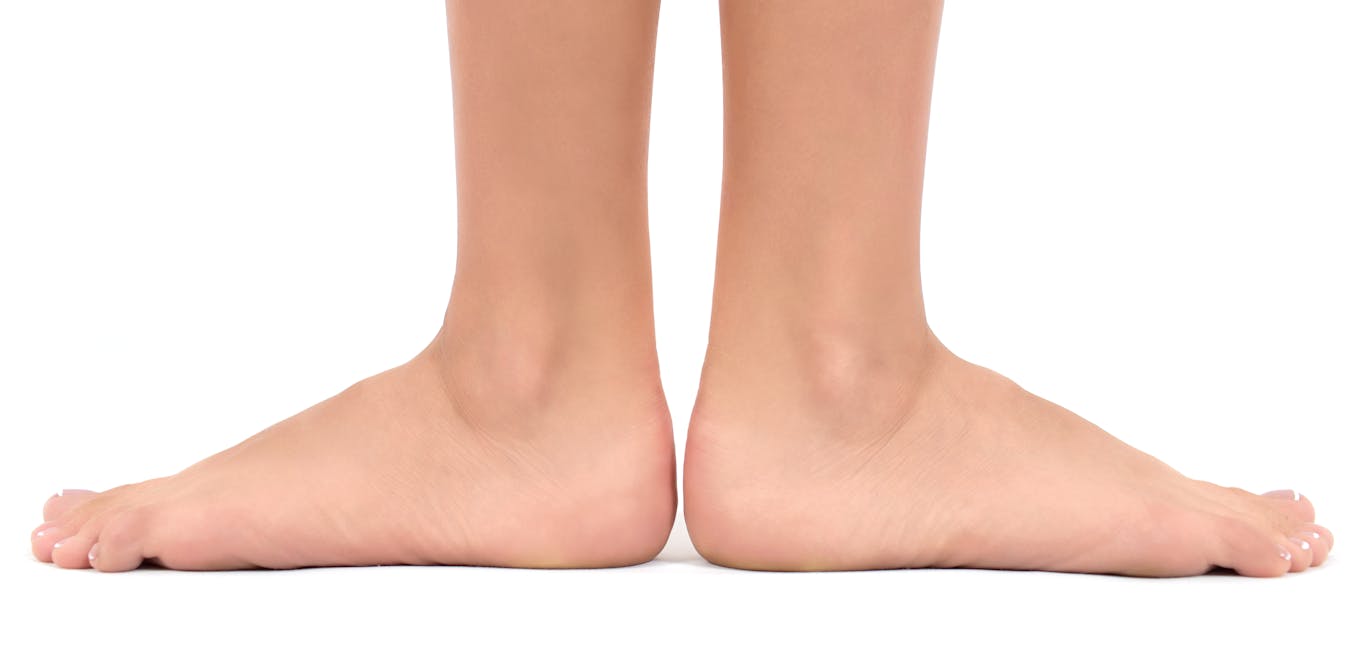 Kebiasaan yang Menyebabkan Kaki Datar