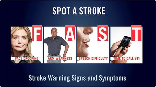 Mitos Tusuk Jarum untuk Tangani Stroke