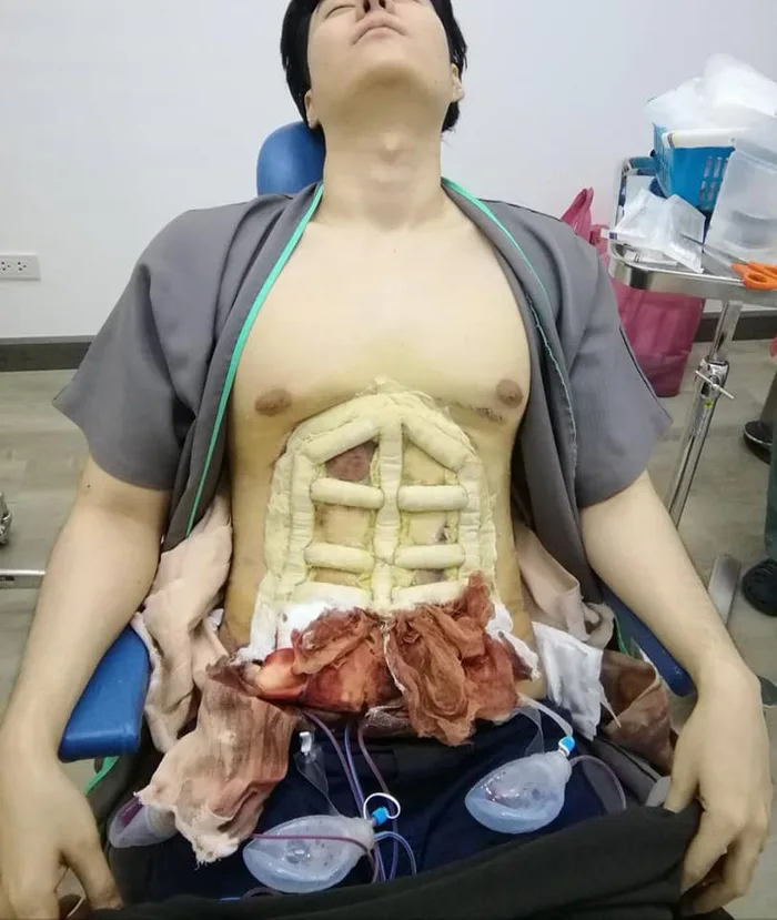 Pingin Six Pack tapi males olahraga??, buruan ke thailand
