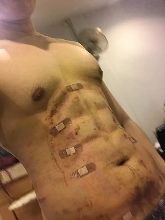 Pingin Six Pack tapi males olahraga??, buruan ke thailand