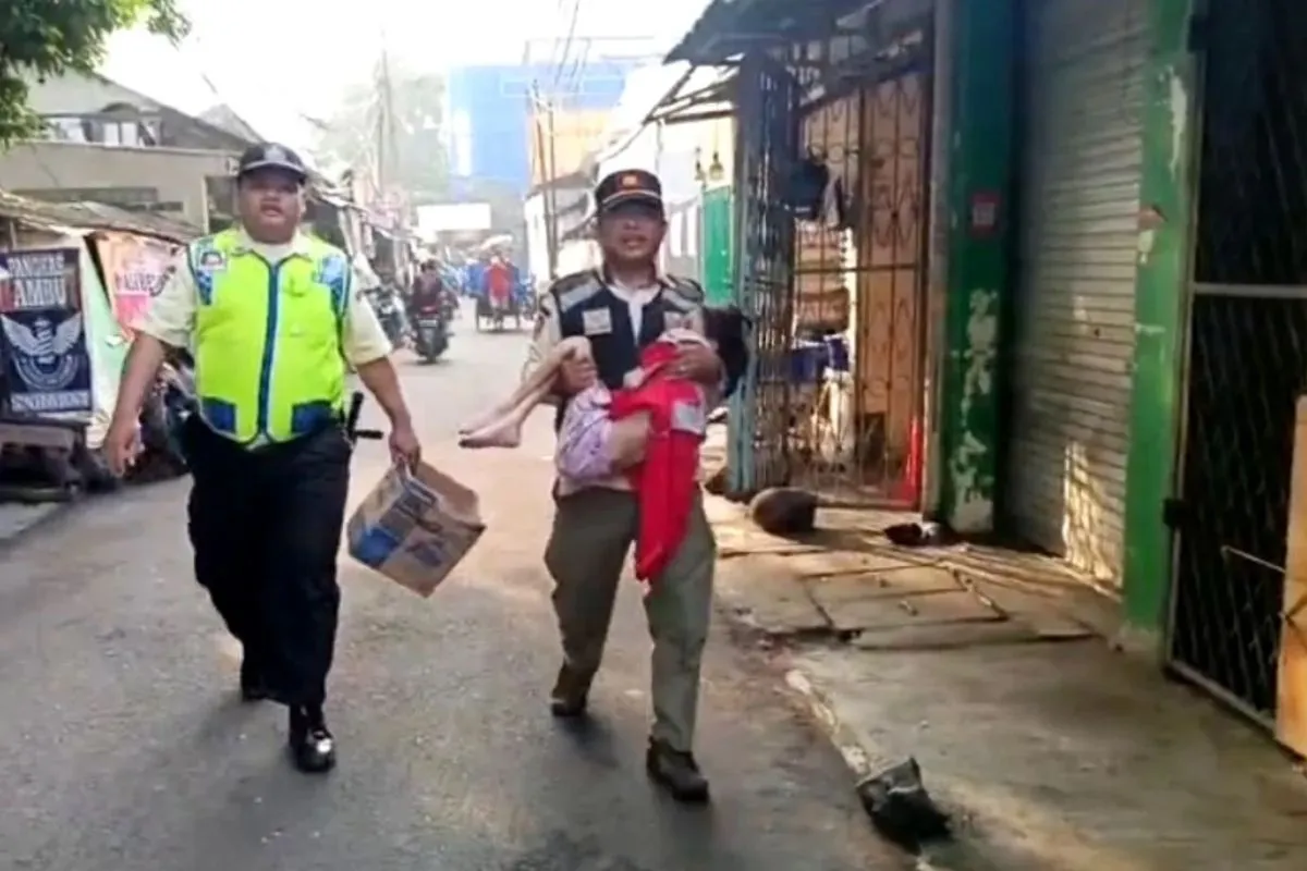 Bocah yang Ditemukan di Pasar Kebayoran Lama Mengaku Pernah Dibakar Ayahnya