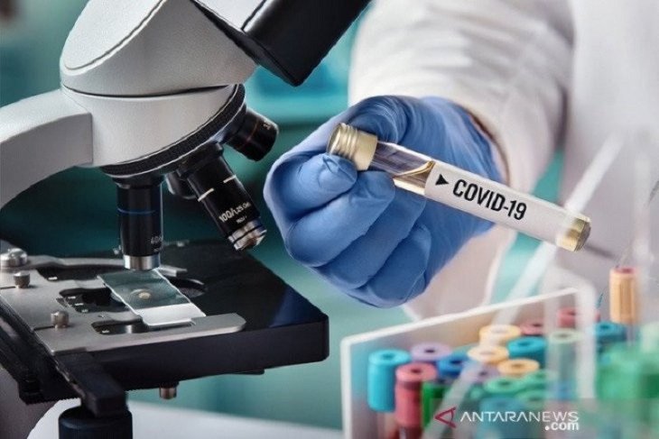 Kemenristek siapkan Rp5 miliar untuk tahap awal riset vaksin COVID-19