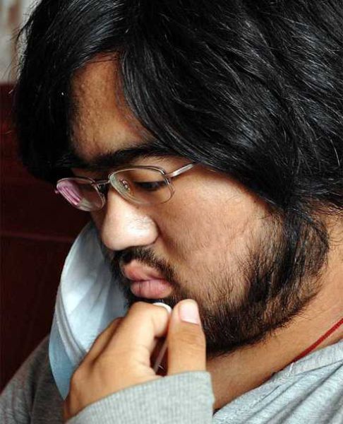 Aneh, Gadis Remaja Ini Wajahnya Ditumbuhi Jenggot
