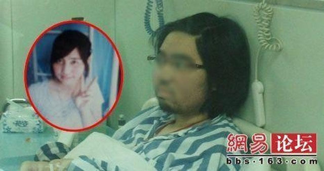 Aneh, Gadis Remaja Ini Wajahnya Ditumbuhi Jenggot