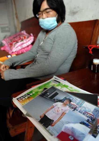 Aneh, Gadis Remaja Ini Wajahnya Ditumbuhi Jenggot