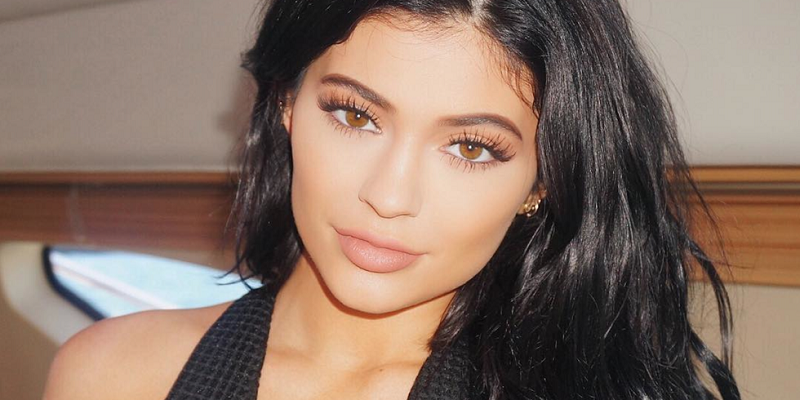 Bibir Seksi Kayak Kylie Jenner? Berikut Fakta Treatment Filler Ini!