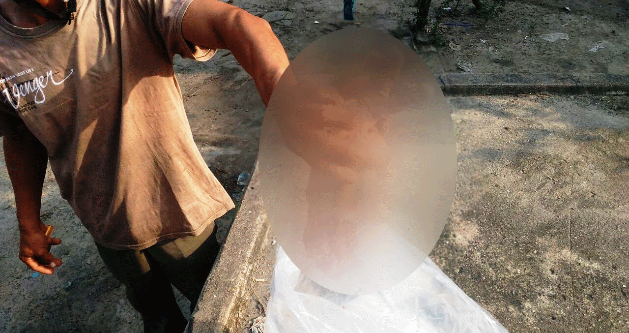 tangan-buruh-putus-saat-bekerja-perusahaan-tak-sediakan-asuransi