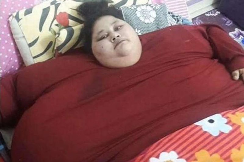 Perempuan Terberat di Dunia akan Jalani Operasi Penurunan Bobot