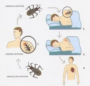 MEMATIKAN!! CHAGAS DIASEASE.. AIDS Generasi Ke 2