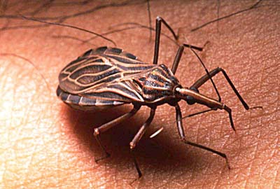 MEMATIKAN!! CHAGAS DIASEASE.. AIDS Generasi Ke 2