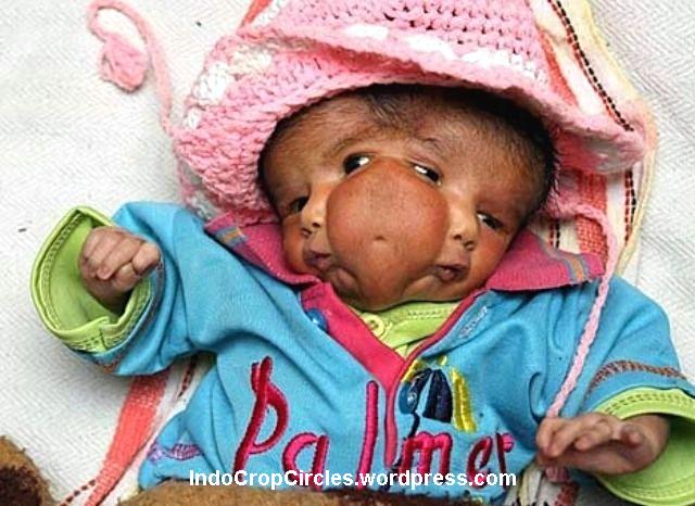 10 Bayi Yang Lahir Tidak Normal Yang Memilukan &#91;PICT + VIDEOS&#93;