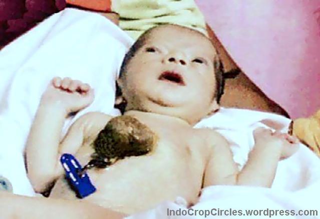 10 Bayi Yang Lahir Tidak Normal Yang Memilukan &#91;PICT + VIDEOS&#93;