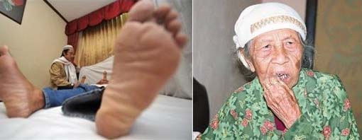 Cara Kerja Mak Erot dan On Clinik