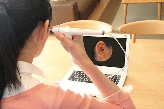 EAR SCOPE WINDOWS, KOREK KUPING BERTEKNOLOGI TINGGI 