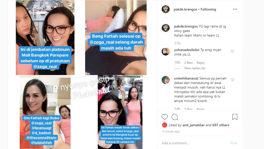 Beredar Foto Lucinta Luna Pertama Kali Oplas Payudara