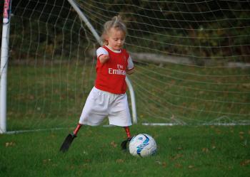 Anak Kecil Tanpa Tangan dan Kaki Bermain Bola