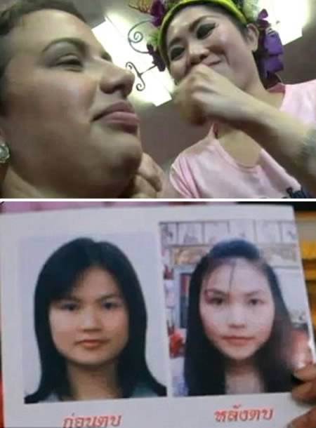 9 Terapi Paling Aneh di Dunia. Mau Coba? (Agak BB dikt)