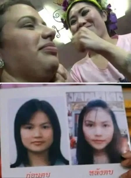 8 Perawatan Wajah Paling Ekstrem