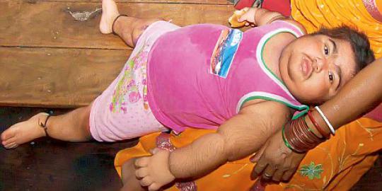 &#91;aneh tapi nyata&#93; Bocah India 18 bulan tumbuh kumis dan jenggot