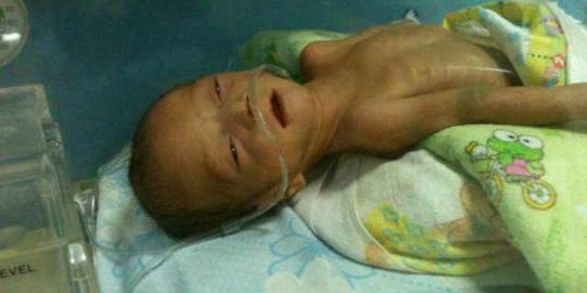  Dera, bayi yang sakit pernapasan ditolak 5 RS di Jakarta (Akhirnya Meninggal)