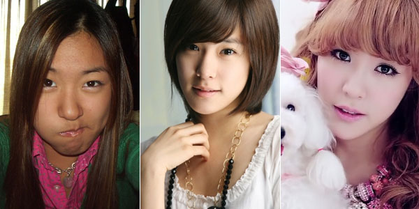 Wajah artis korea sebelum dan sesudah Operasi Plastik 