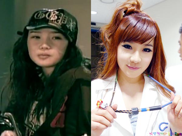 Wajah artis korea sebelum dan sesudah Operasi Plastik 
