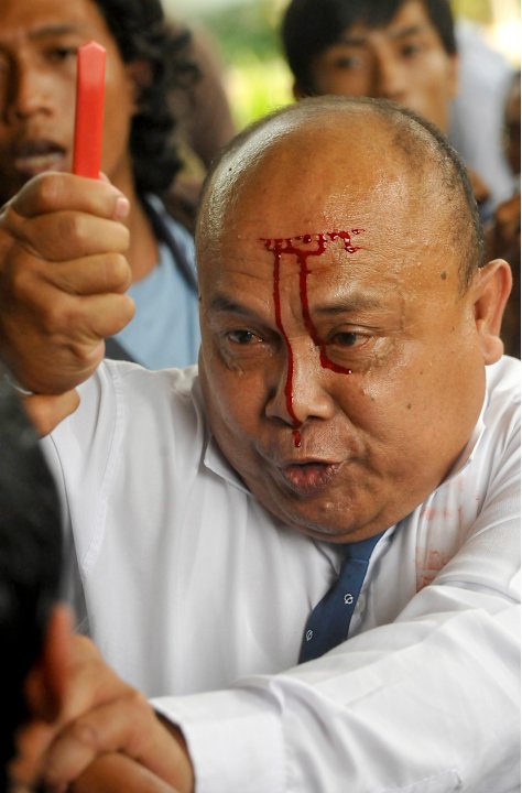 Anti Korupsi hingga jidat sobek berdarah-darah.............