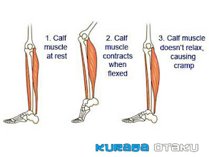 Pengalaman Nocturnal Leg Cramps