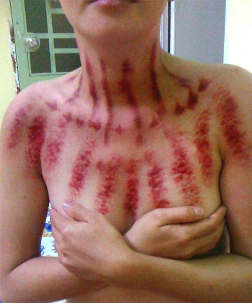 pernikahan-kontroversial-2-maho-kaskuser-sidoarjo