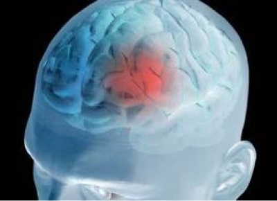 Petolongan Pertama Stroke Tusuk Jari Hoax