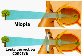 10 Penyakit dan Gangguan Pada Mata