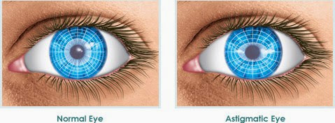 10 Penyakit dan Gangguan Pada Mata