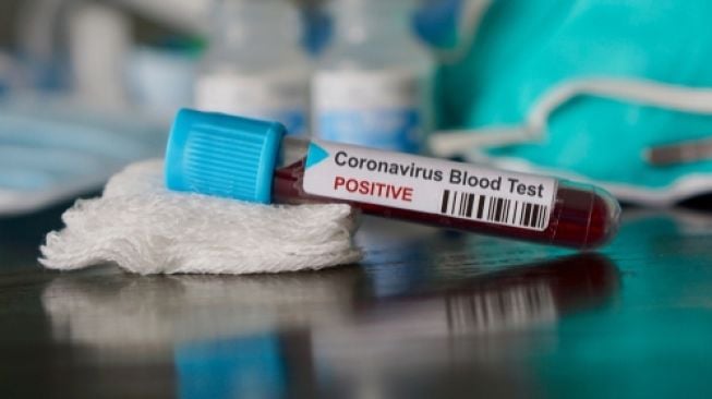 virus-corona-untuk-kita-renungkan