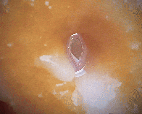 post-image