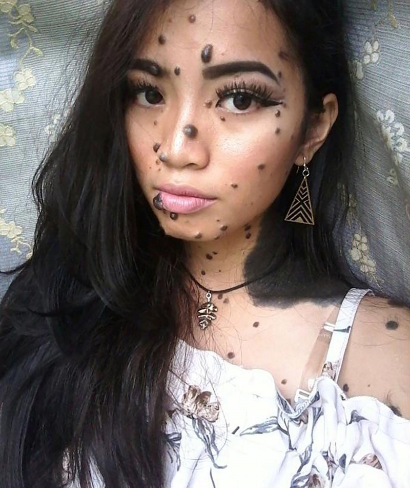 Dengan Tahi Lalat di Sekujur Tubuhnya, Cewek Ini PD Ikutan Miss Universe