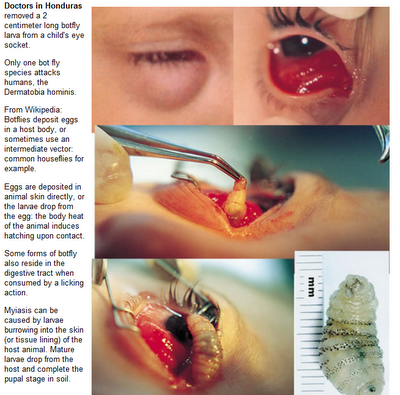 Lalat BOTFLY Bertelur Di Dalam Tubuh Manusia