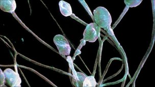 &#91;Fakta Penelitian&#93; Sperma Pria Perancis Berkurang Hingga Sepertiganya