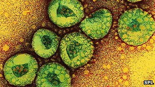 Saudi Arabia Sars-like virus 'kills five'