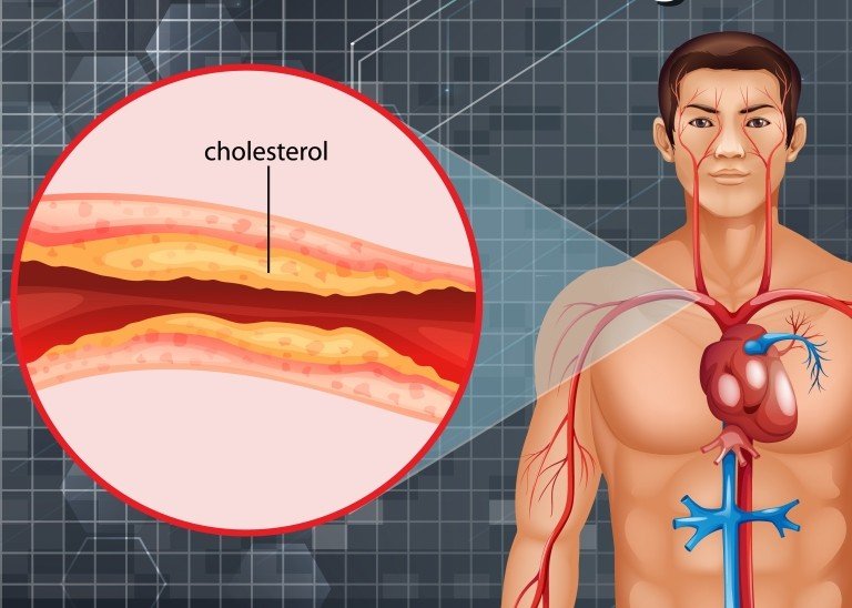 tips-menjaga-kolesterol-jahat