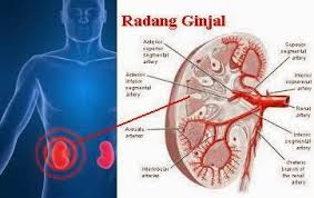 10 Kelainan Pada Ginjal Yang Berbahaya